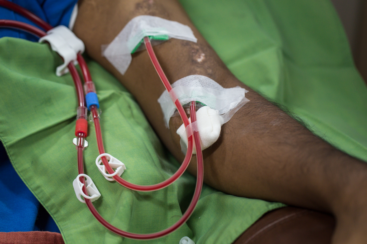Blood transfusions, dialysis
