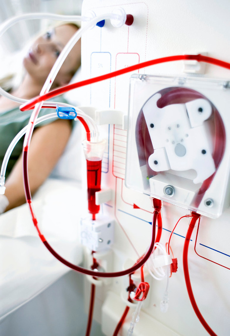 Kidney dialysis.