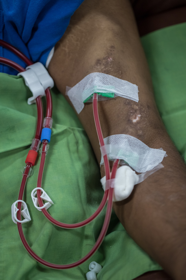 Blood transfusions, dialysis