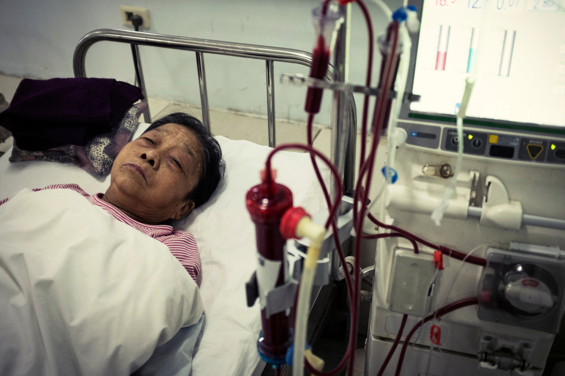 My grandmother is dialysis