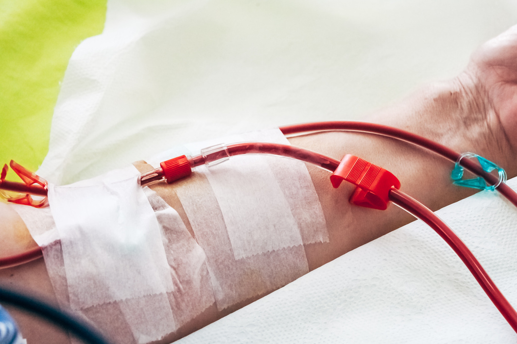 Hemodialysis in a Modern Dialysis Center
