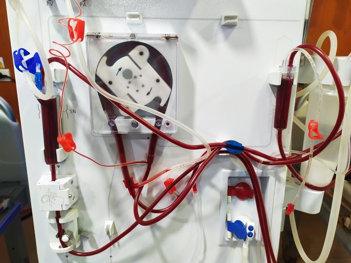 dialysis machine