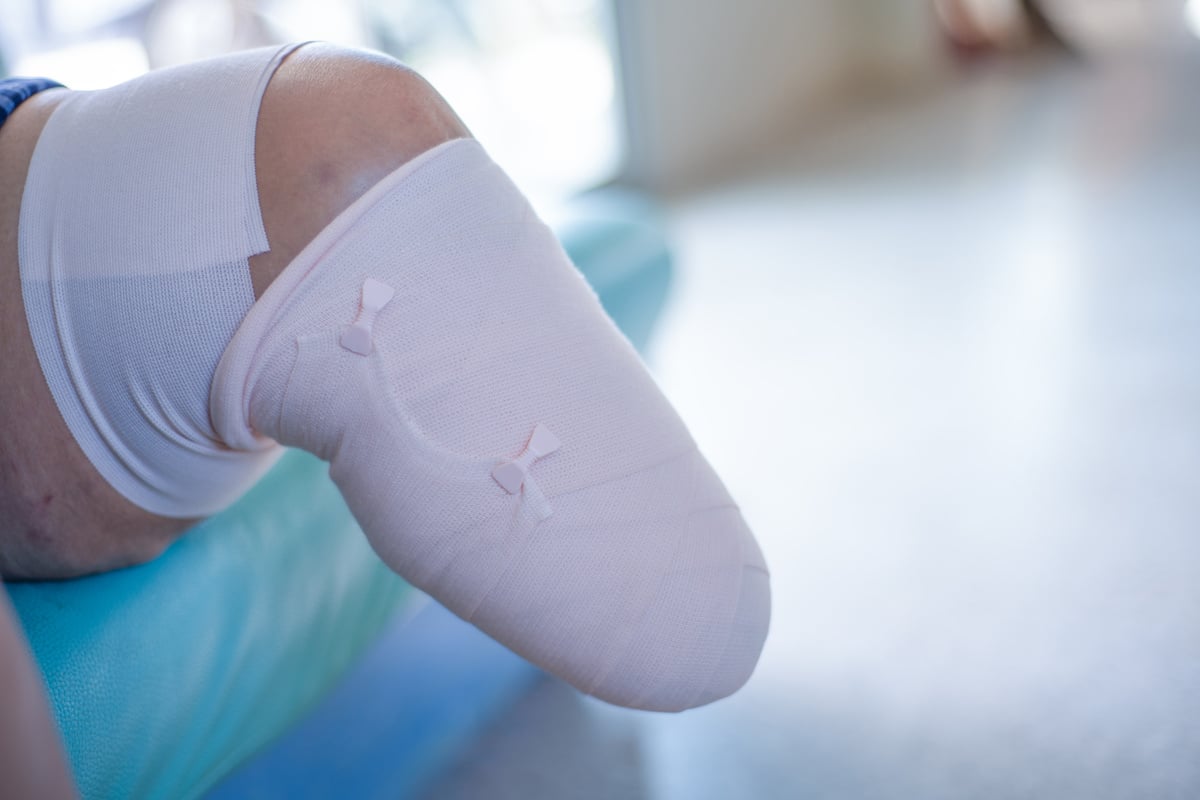 Amputee Patient With Leg Bandaged